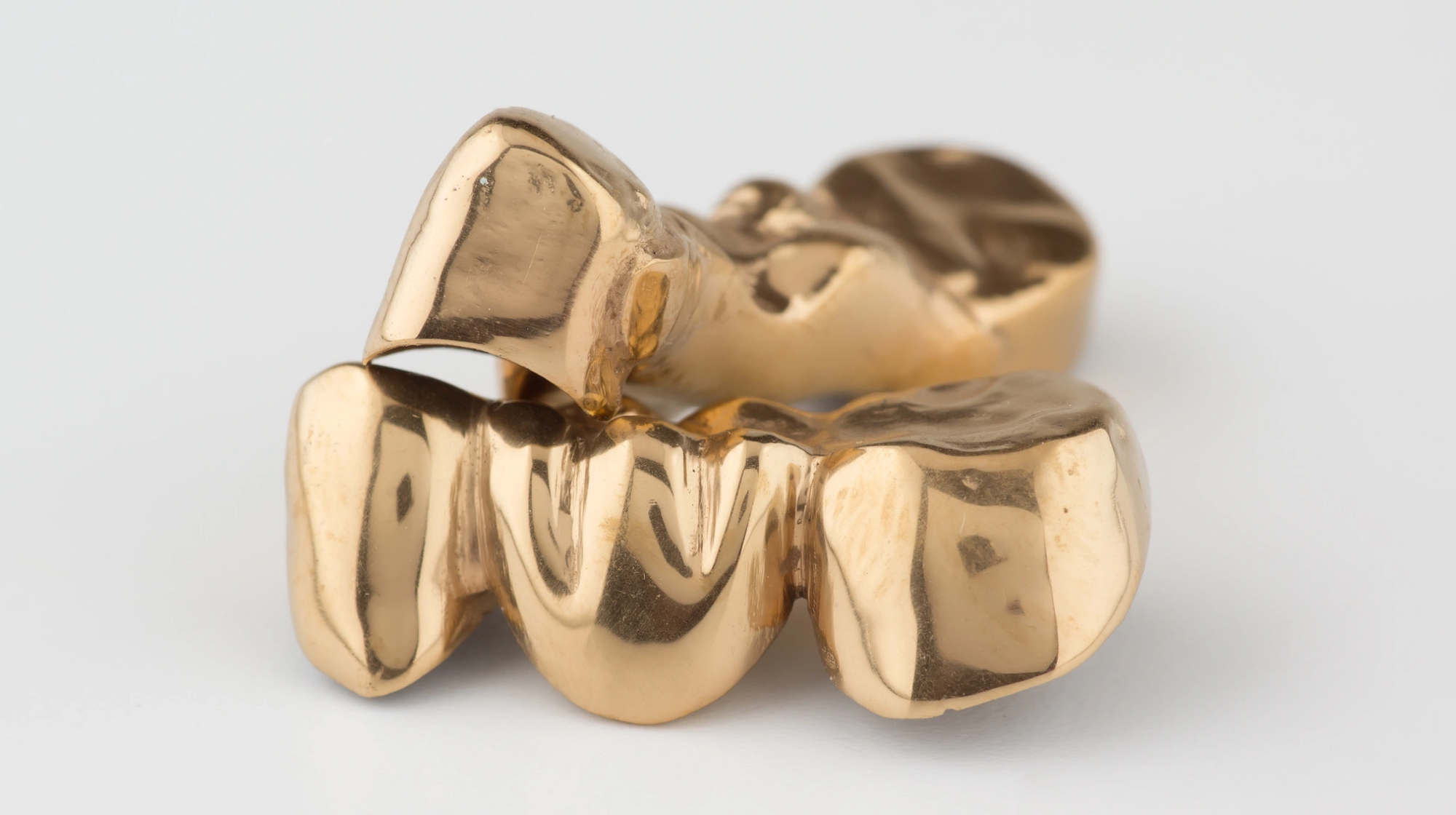 Zahngold Ankauf Bochum: Zahngold verkaufen Bochum, Zahngold Bochum, Ankauf Zahngold Bochum & Zahngold Ankauf in Bochum. Zahngold Wert Bochum, Zahngold Preis