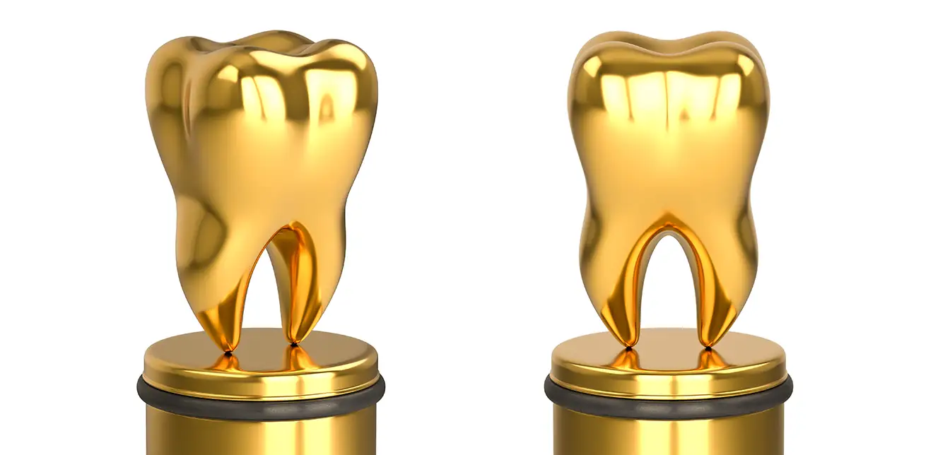 Zahngold verkaufen in Witten – Wie viel ist Dentalgold wert?